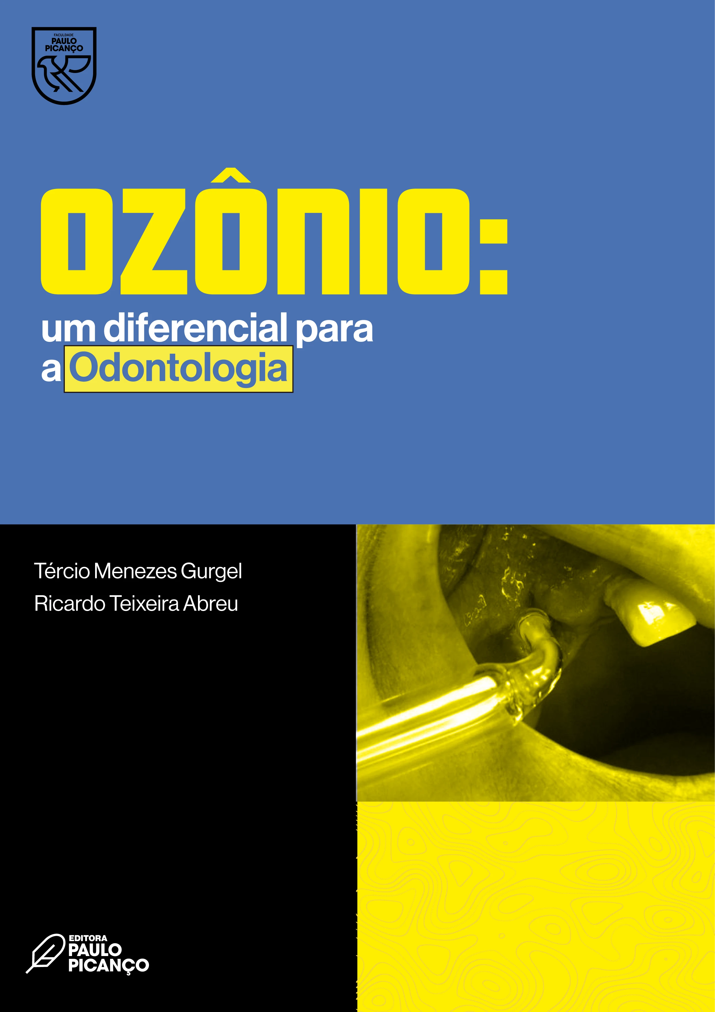 Ozônio: Um diferencial para a Odontologia 