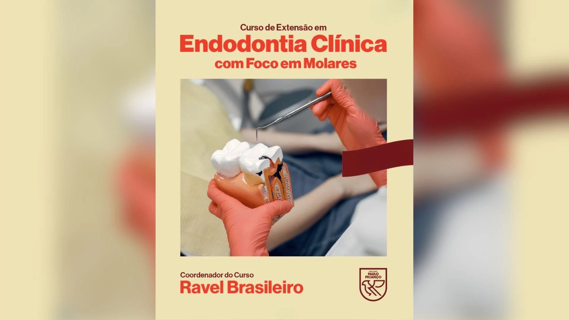 FACPP abre inscrições para extensão em Endodontia Clínica com foco em molares